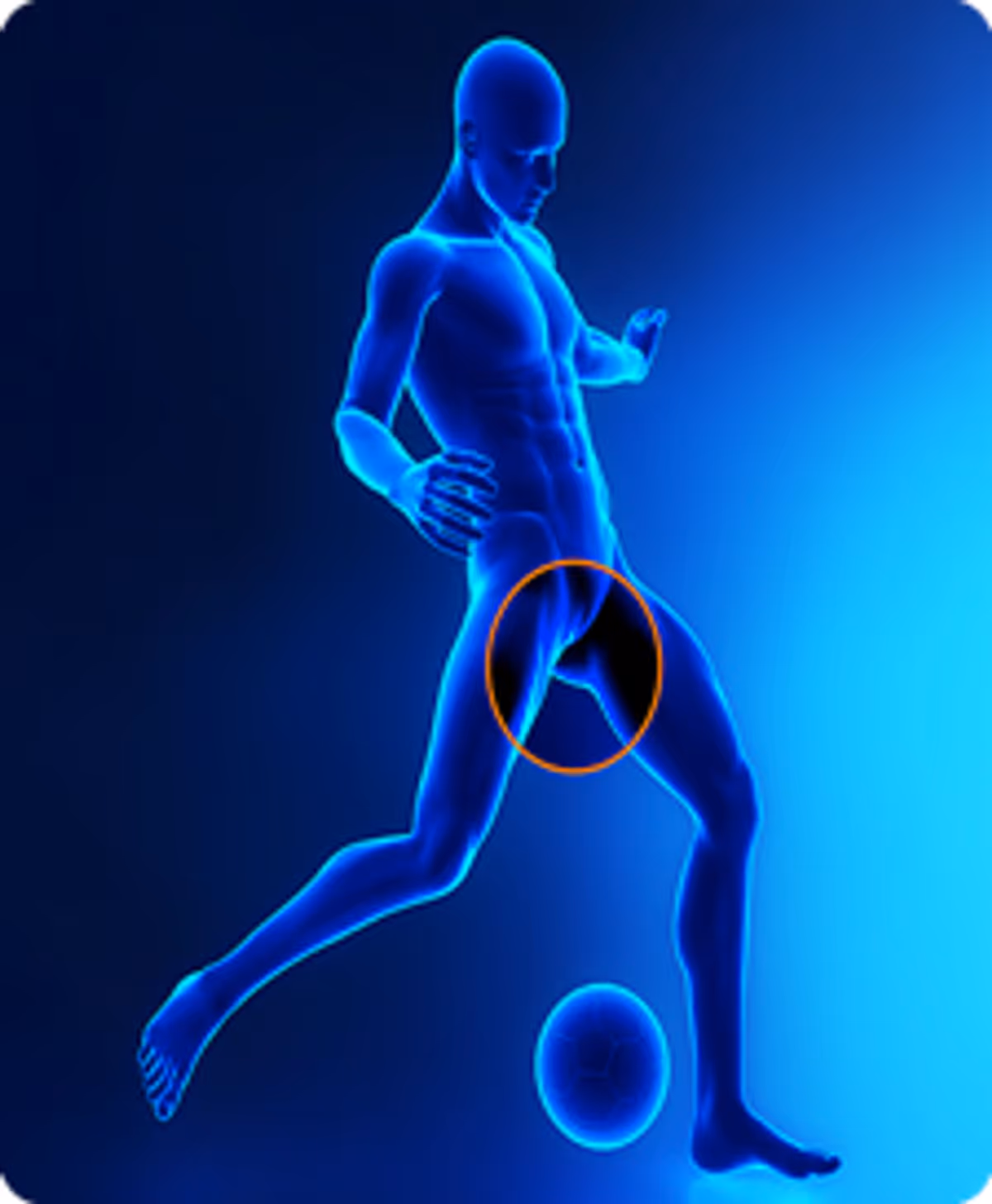 Sports hernia image